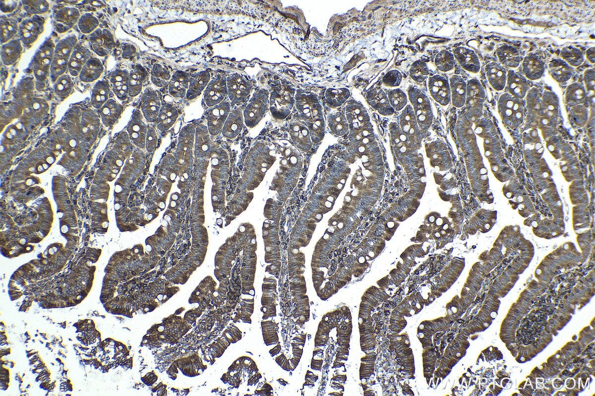 Immunohistochemical analysis of paraffin-embedded rat small intestine tissue slide using KHC1434 (ARPC2 IHC Kit).