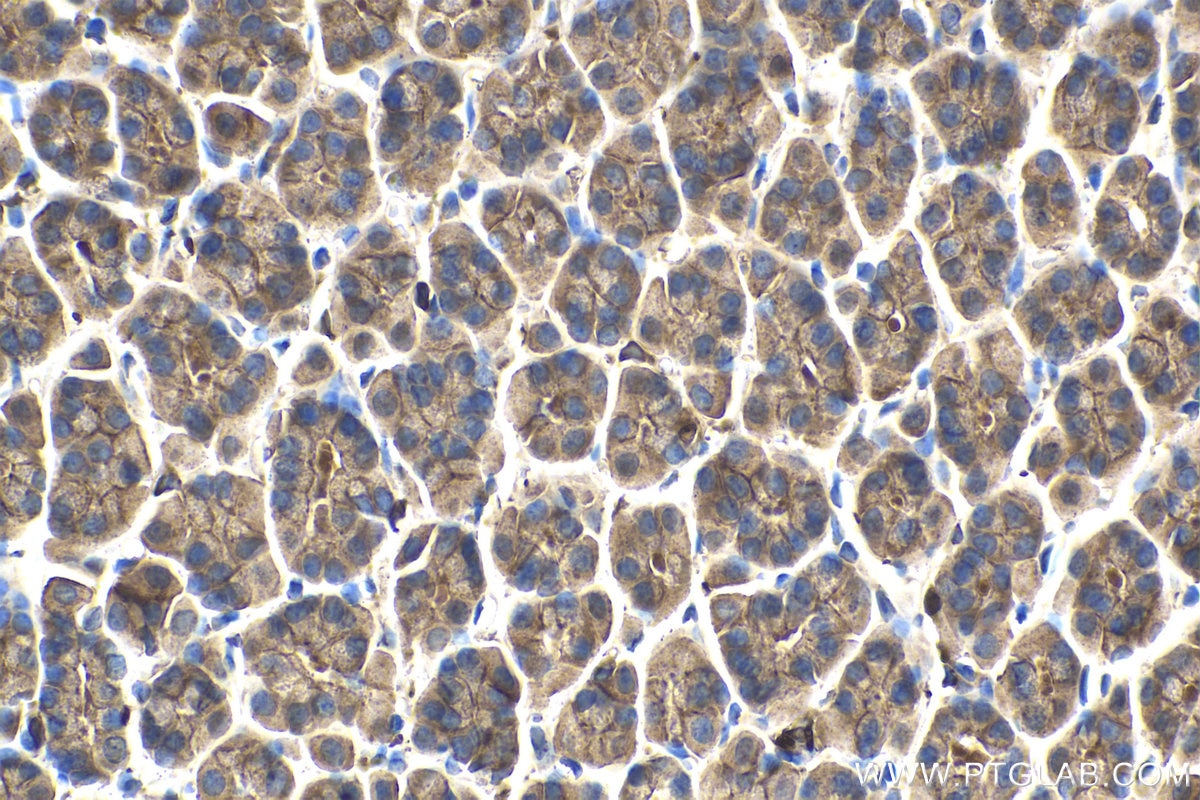Immunohistochemical analysis of paraffin-embedded rat stomach tissue slide using KHC1434 (ARPC2 IHC Kit).