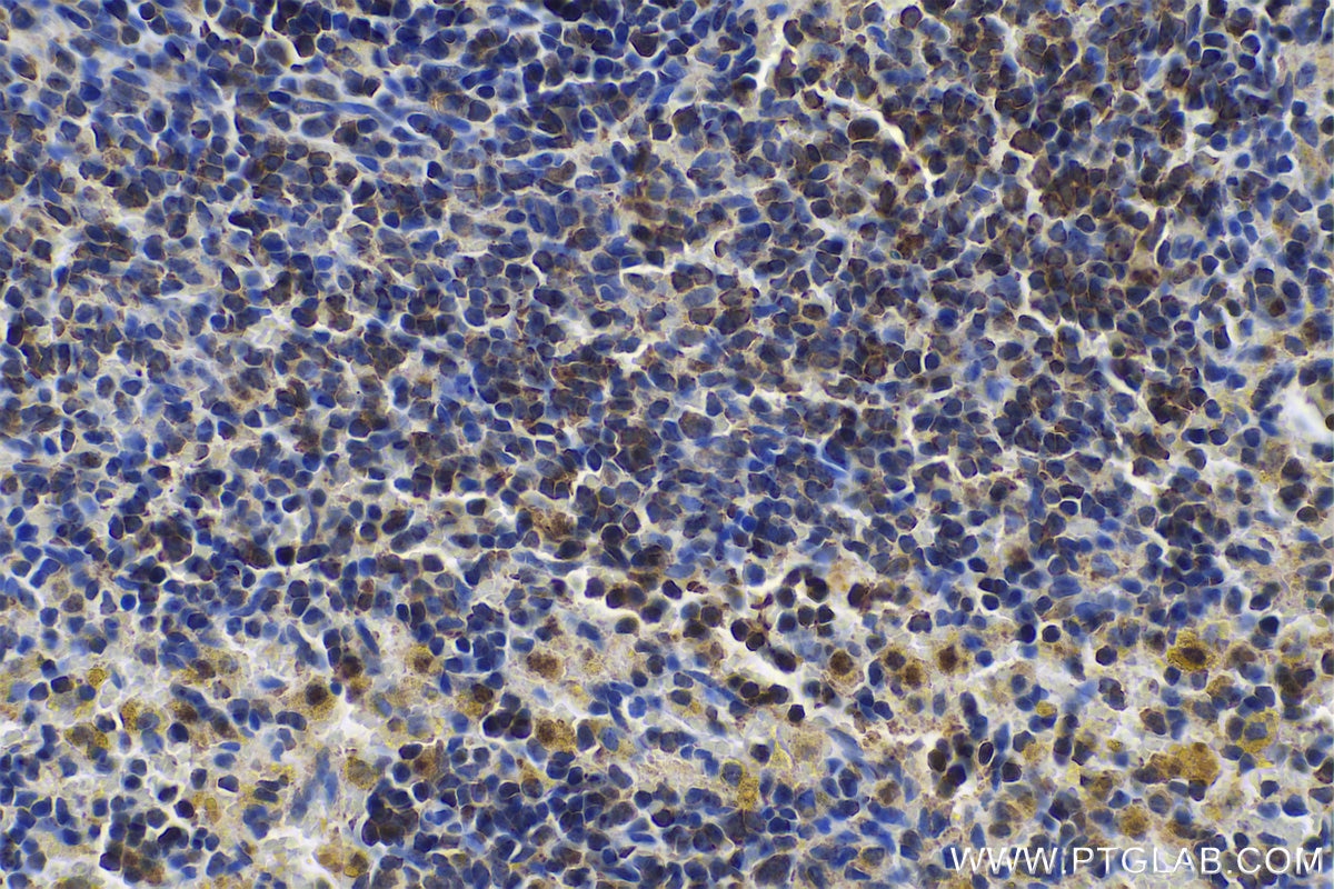 Immunohistochemical analysis of paraffin-embedded rat spleen tissue slide using KHC0704 (ARPC3 IHC Kit).