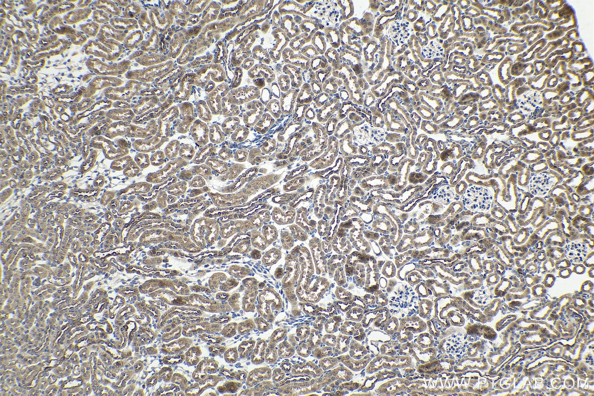 Immunohistochemical analysis of paraffin-embedded mouse kidney tissue slide using KHC1636 (ARPC4 IHC Kit).