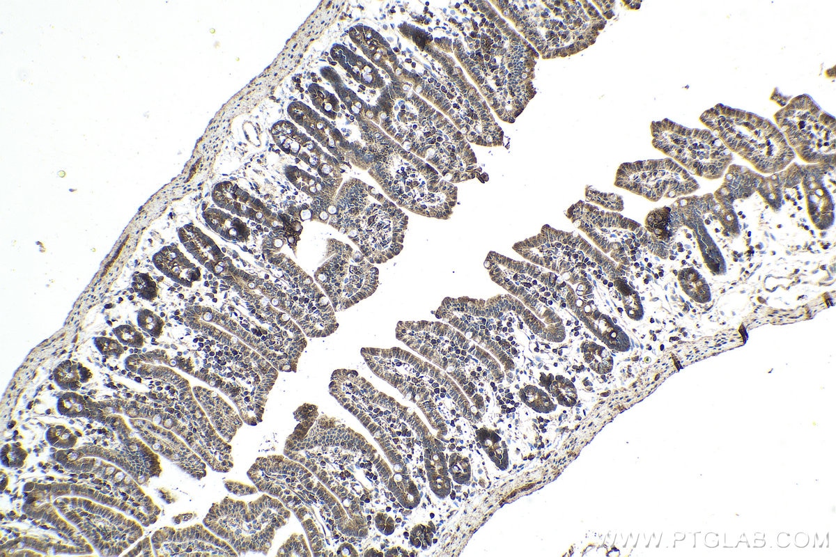 Immunohistochemical analysis of paraffin-embedded mouse small intestine tissue slide using KHC1636 (ARPC4 IHC Kit).