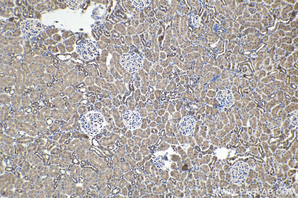 Immunohistochemical analysis of paraffin-embedded rat kidney tissue slide using KHC1636 (ARPC4 IHC Kit).