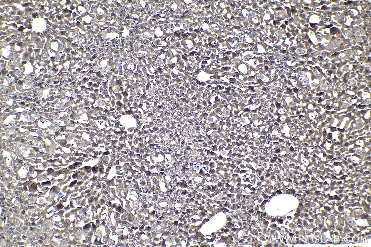 Immunohistochemical analysis of paraffin-embedded mouse liver tissue slide using KHC1445 (ARPC5 IHC Kit).