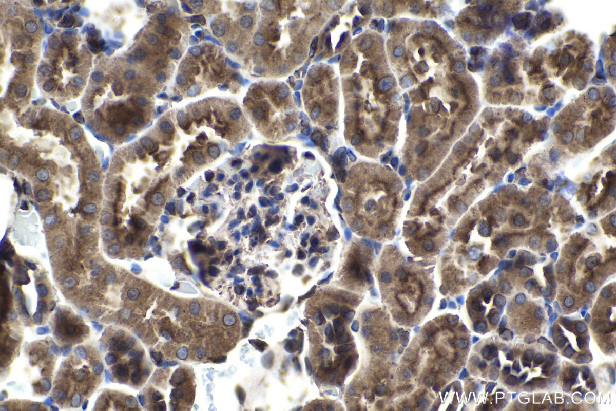 Immunohistochemical analysis of paraffin-embedded rat kidney tissue slide using KHC1445 (ARPC5 IHC Kit).