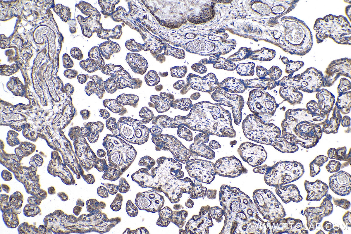 Immunohistochemical analysis of paraffin-embedded human placenta tissue slide using KHC1039 (ARPP19 IHC Kit).