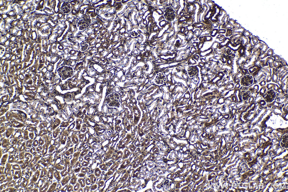 Immunohistochemical analysis of paraffin-embedded mouse kidney tissue slide using KHC1612 (ARRB1 IHC Kit).