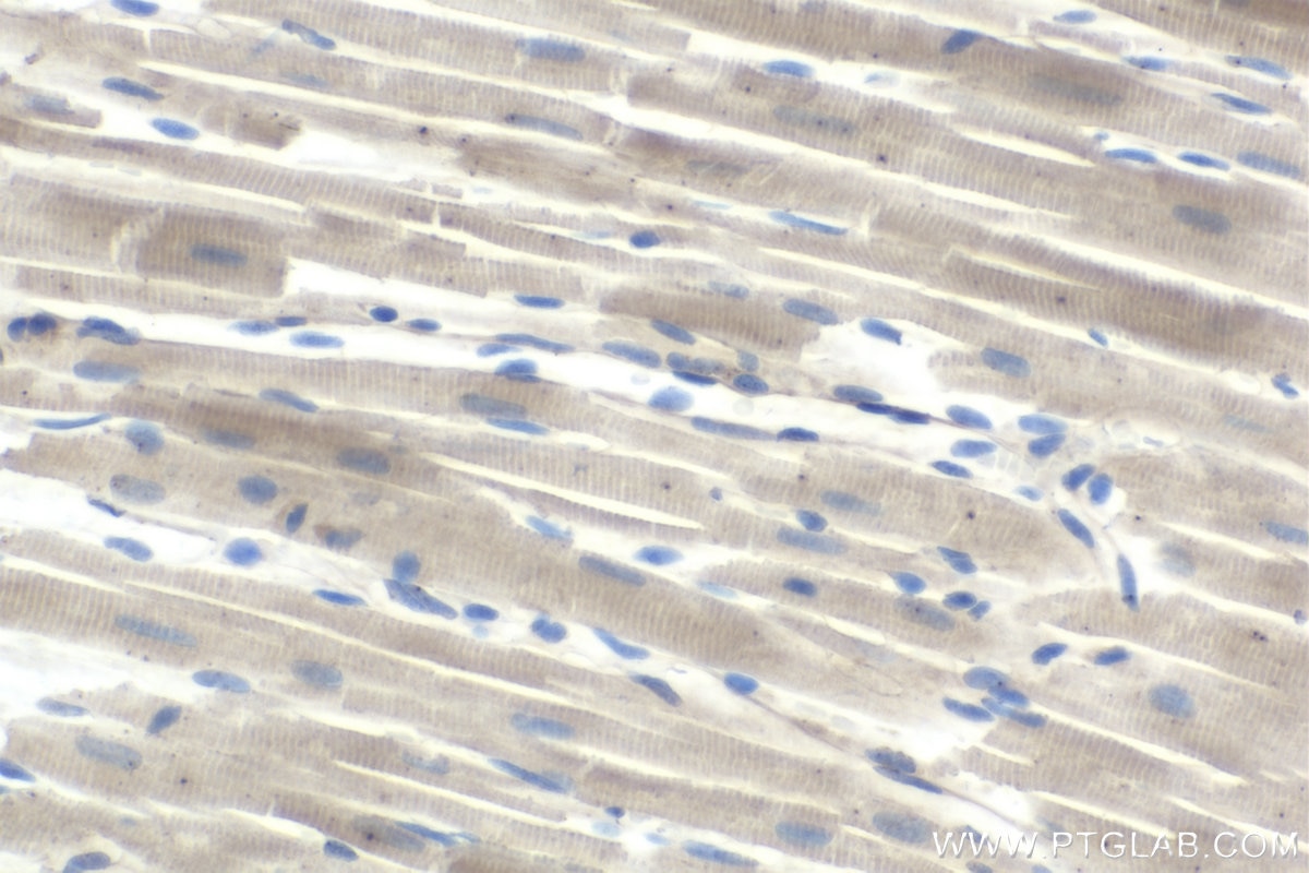 Immunohistochemical analysis of paraffin-embedded rat heart tissue slide using KHC1714 (ASAH1 IHC Kit).