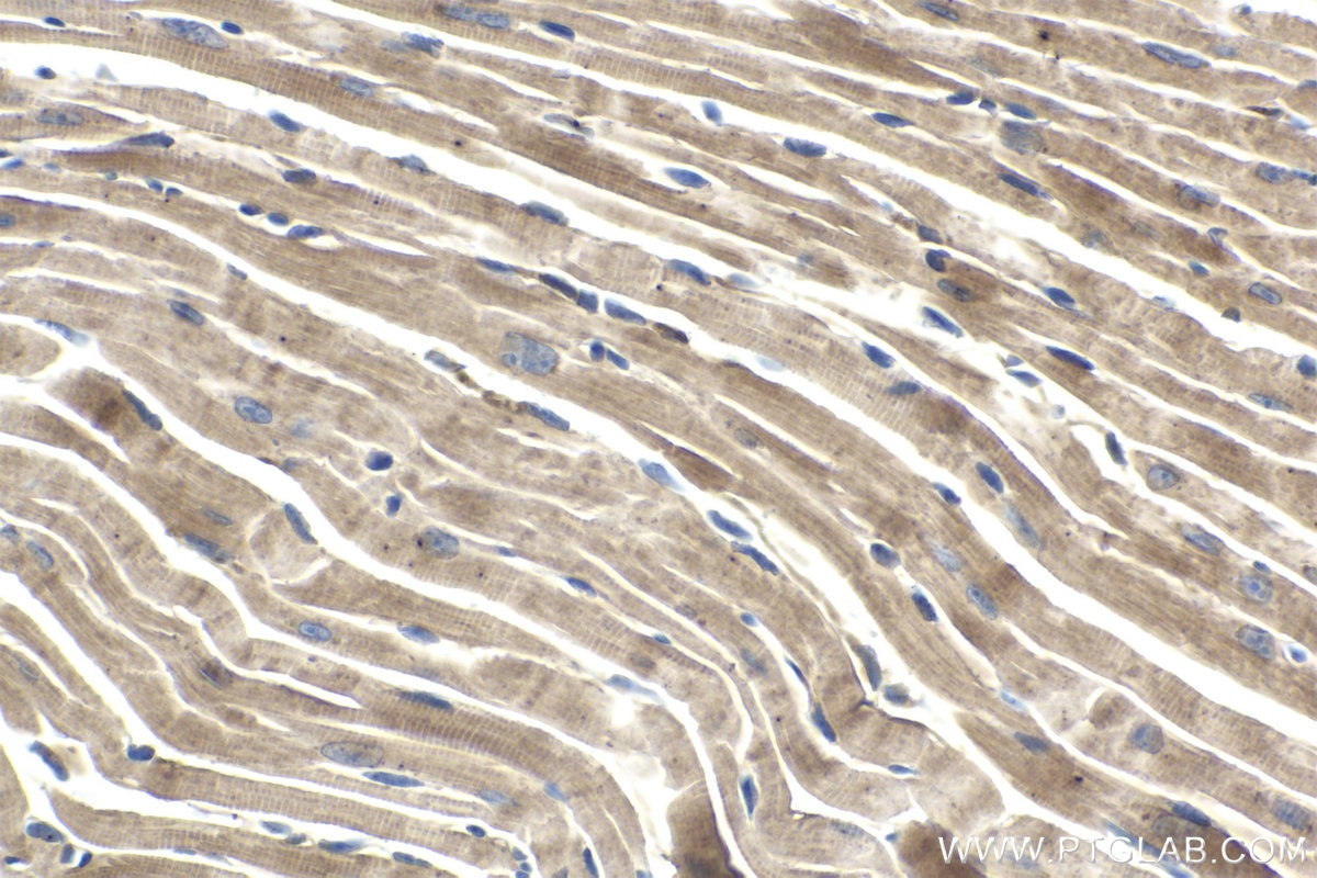 Immunohistochemical analysis of paraffin-embedded mouse heart tissue slide using KHC1714 (ASAH1 IHC Kit).