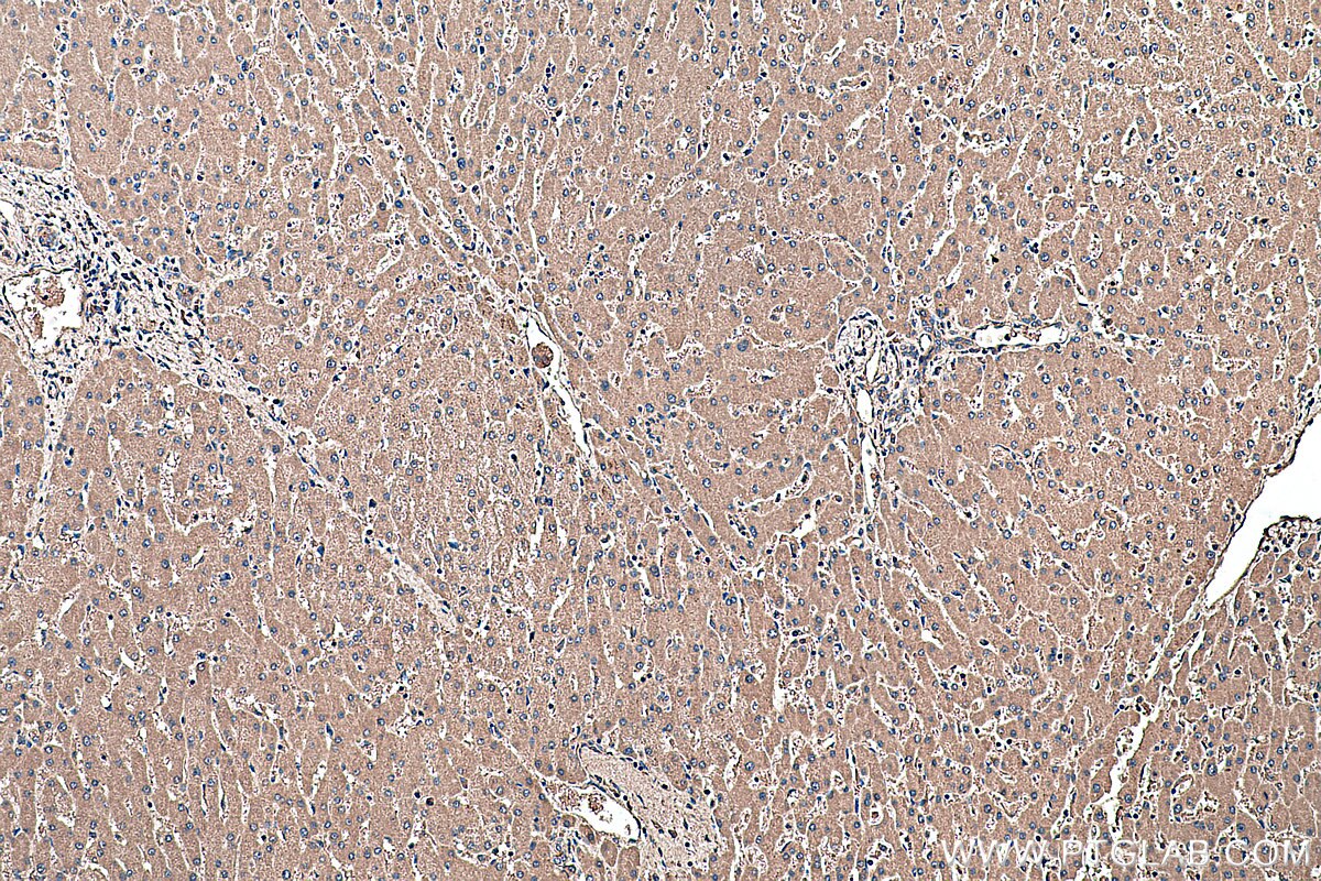 Immunohistochemical analysis of paraffin-embedded human liver tissue slide using KHC0384 (ASGR1 IHC Kit).