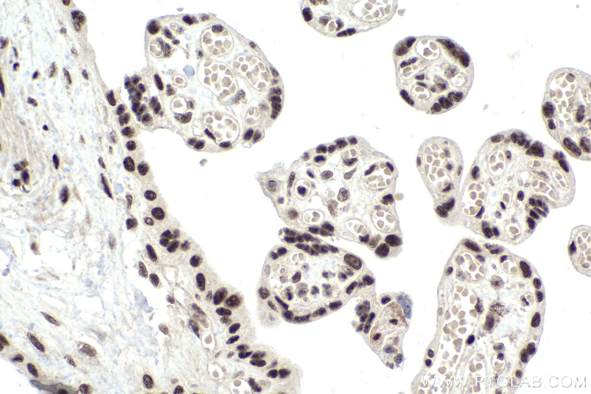 Immunohistochemical analysis of paraffin-embedded human placenta tissue slide using KHC1975 (ASH2L IHC Kit).