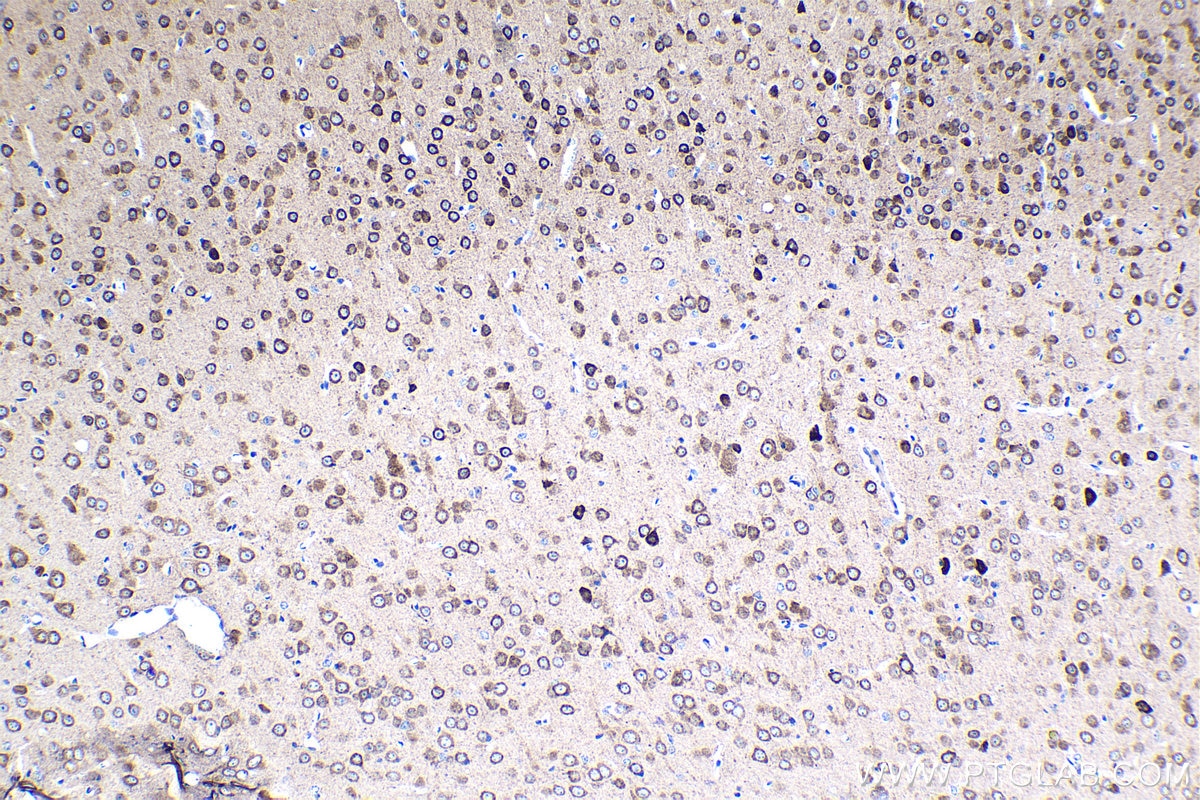 Immunohistochemical analysis of paraffin-embedded mouse brain tissue slide using KHC1234 (ASPH IHC Kit).