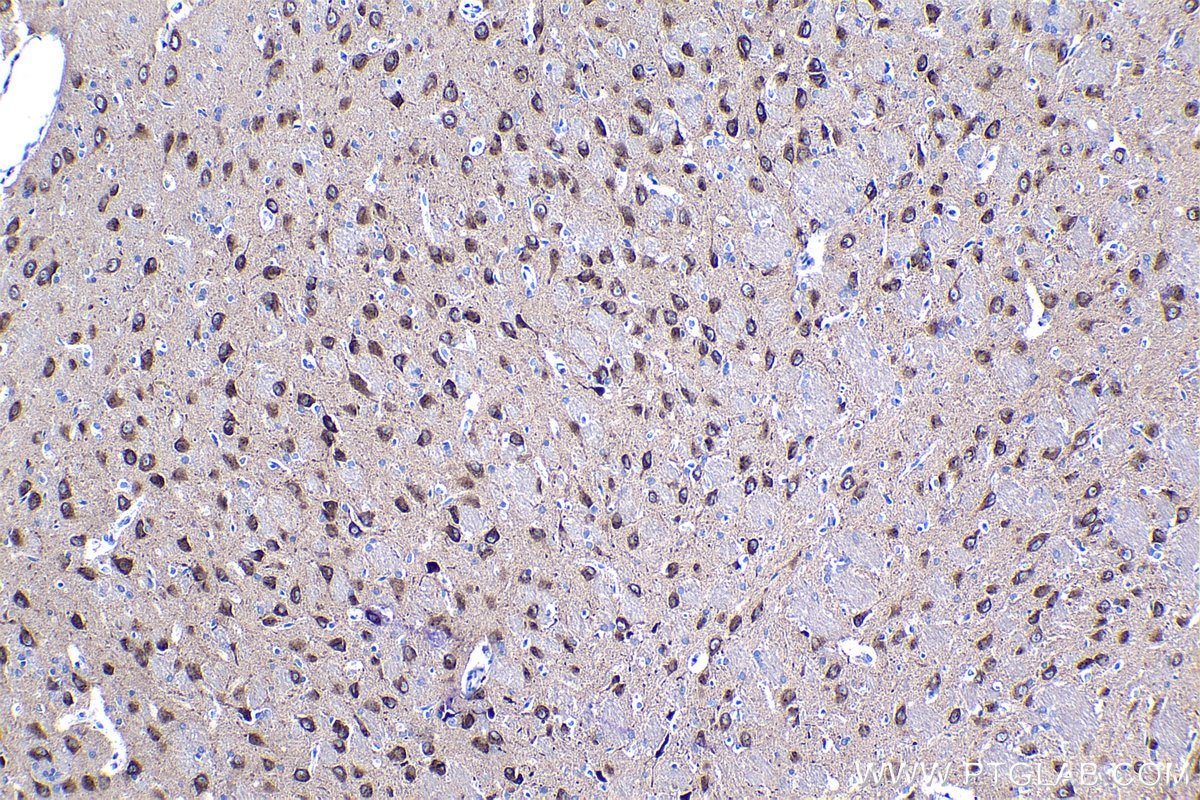 Immunohistochemical analysis of paraffin-embedded rat brain tissue slide using KHC1234 (ASPH IHC Kit).