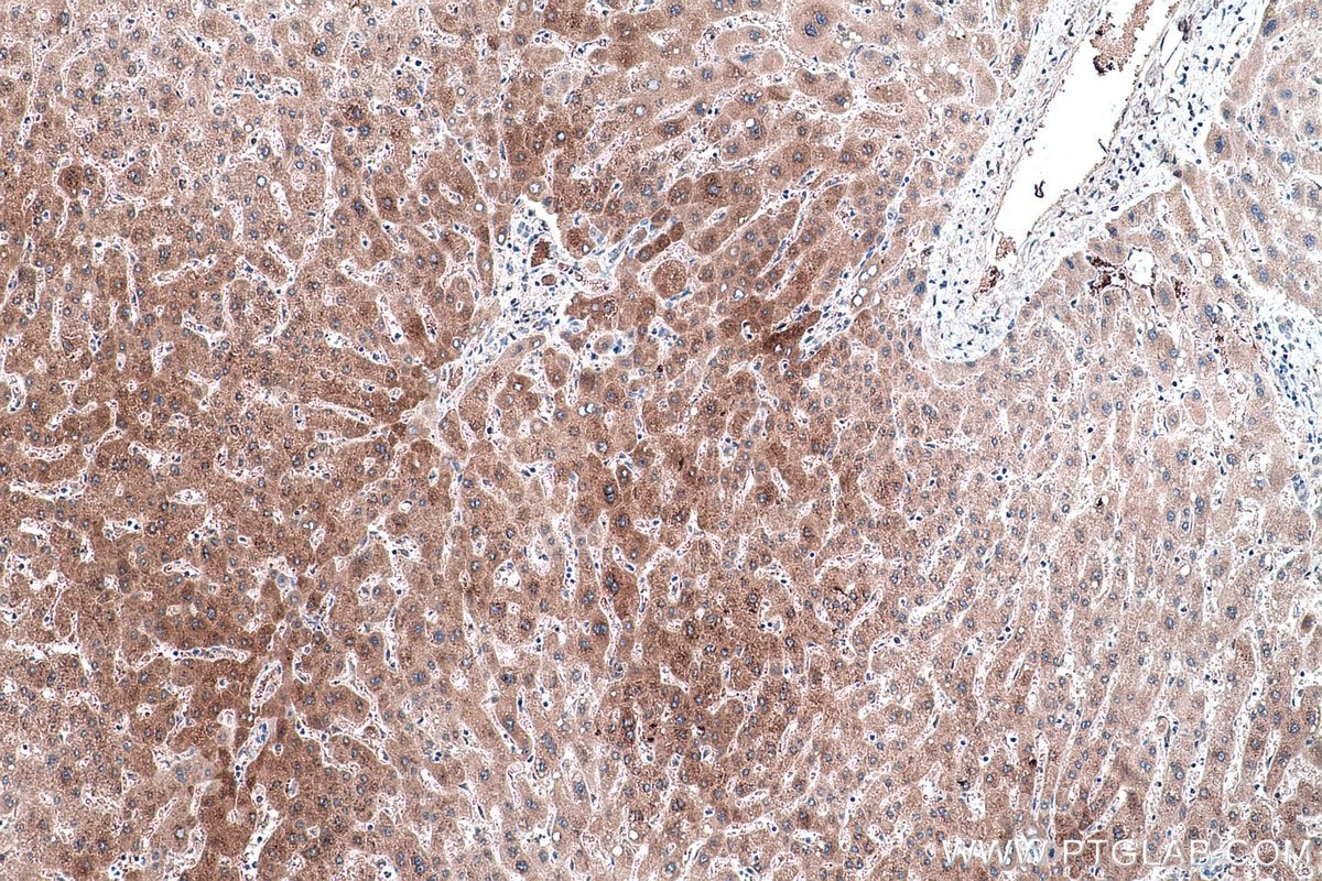 Immunohistochemical analysis of paraffin-embedded human liver tissue slide using KHC0476 (ASS1 IHC Kit).