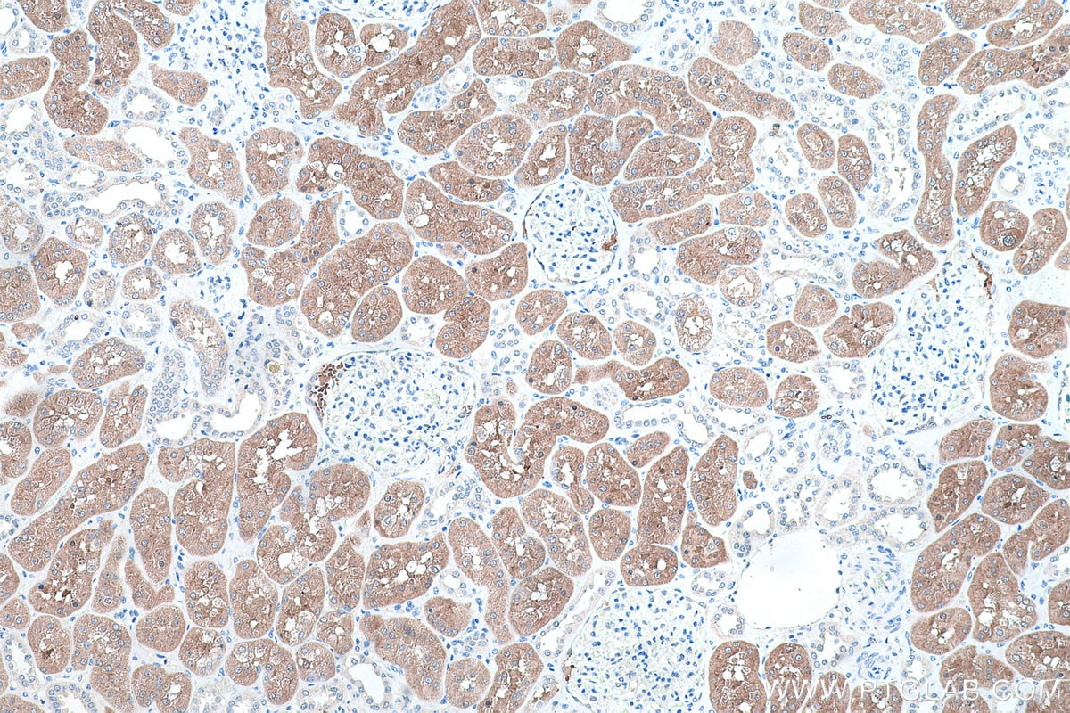 Immunohistochemical analysis of paraffin-embedded human kidney tissue slide using KHC0476 (ASS1 IHC Kit).