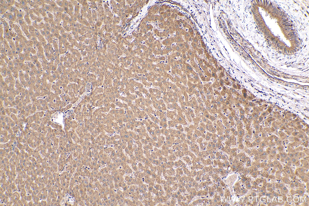 Immunohistochemical analysis of paraffin-embedded human liver tissue slide using KHC0400 (ASUN IHC Kit).