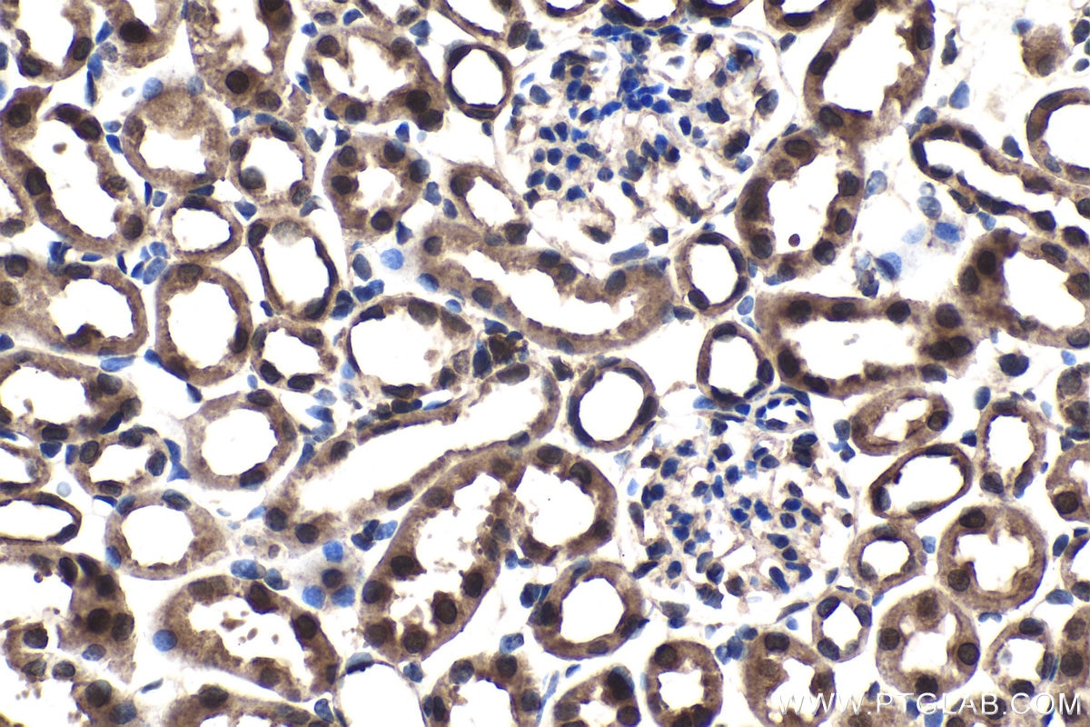 Immunohistochemical analysis of paraffin-embedded mouse kidney tissue slide using KHC1543 (ATF4 IHC Kit).
