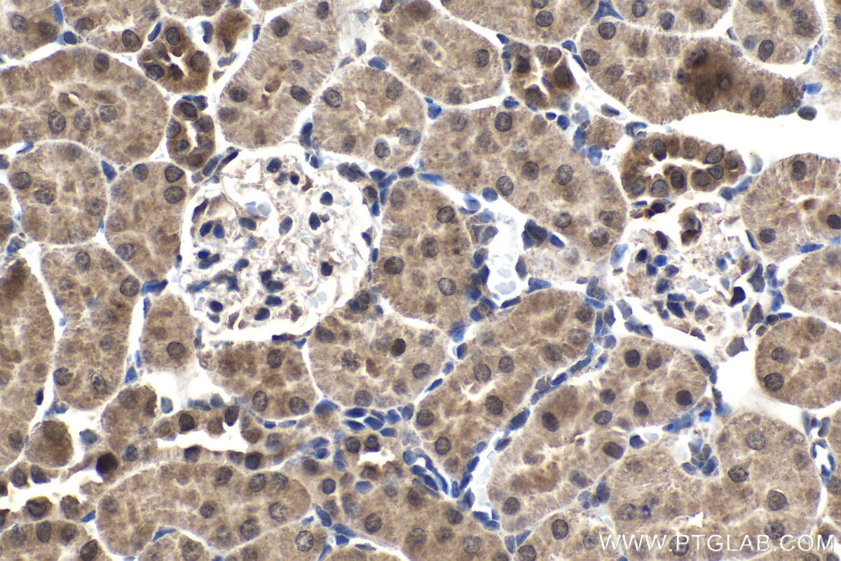 Immunohistochemical analysis of paraffin-embedded rat kidney tissue slide using KHC1543 (ATF4 IHC Kit).