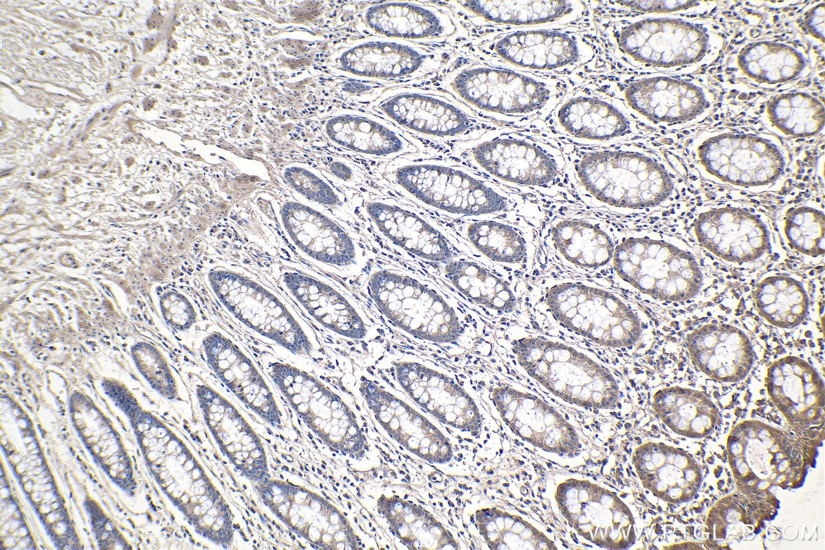 Immunohistochemical analysis of paraffin-embedded human colon tissue slide using KHC1115 (ATF6 IHC Kit).