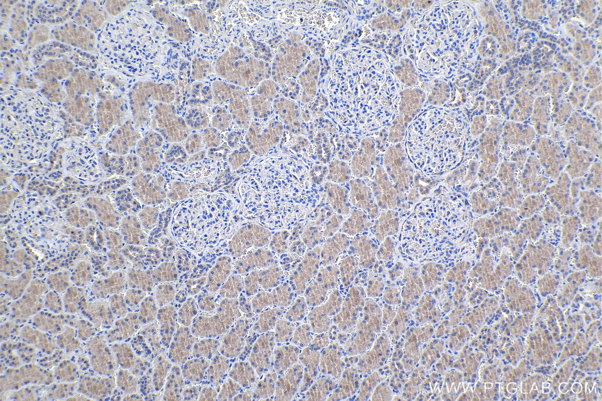 Immunohistochemical analysis of paraffin-embedded human kidney tissue slide using KHC1115 (ATF6 IHC Kit).