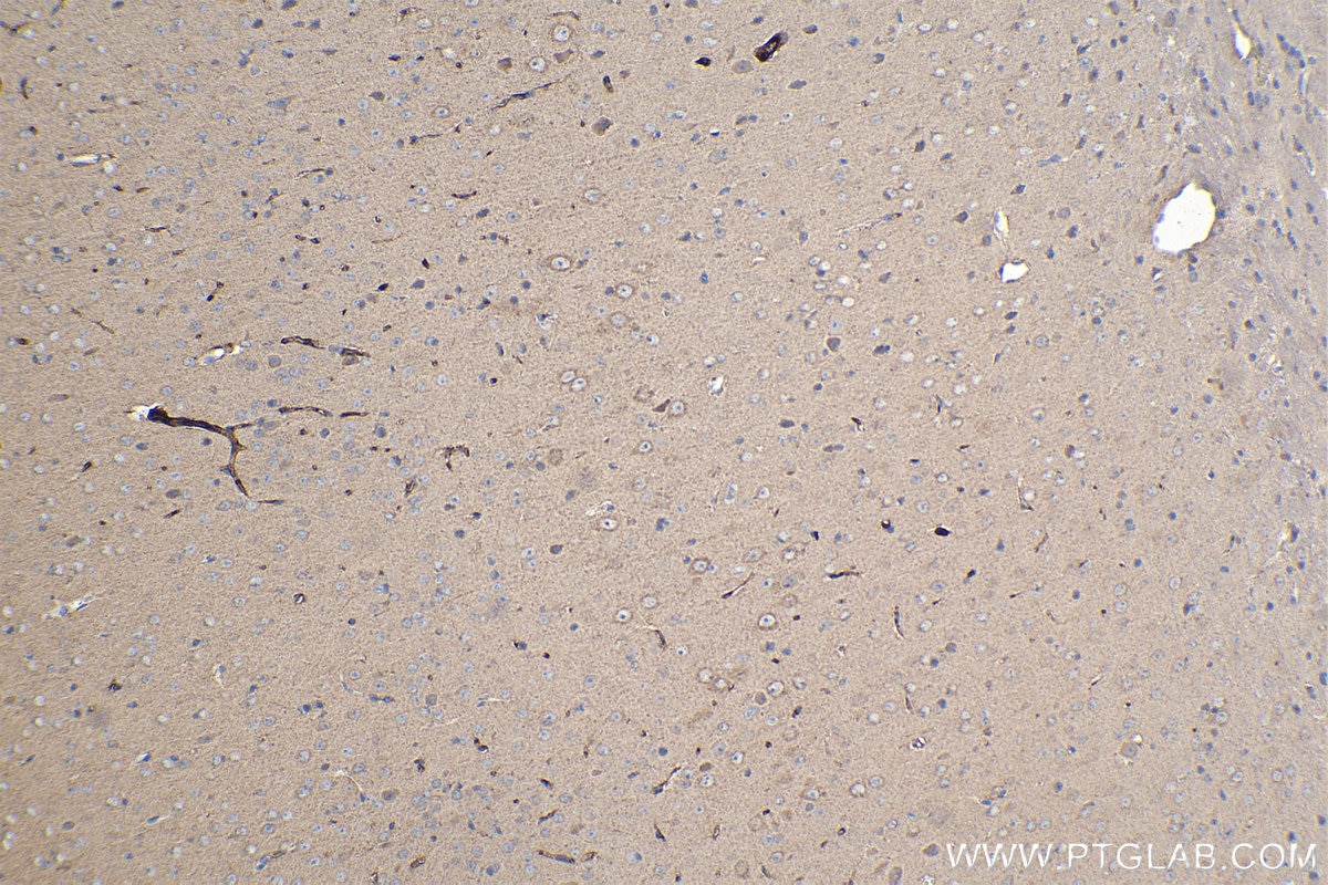 Immunohistochemical analysis of paraffin-embedded mouse brain tissue slide using KHC1115 (ATF6 IHC Kit).