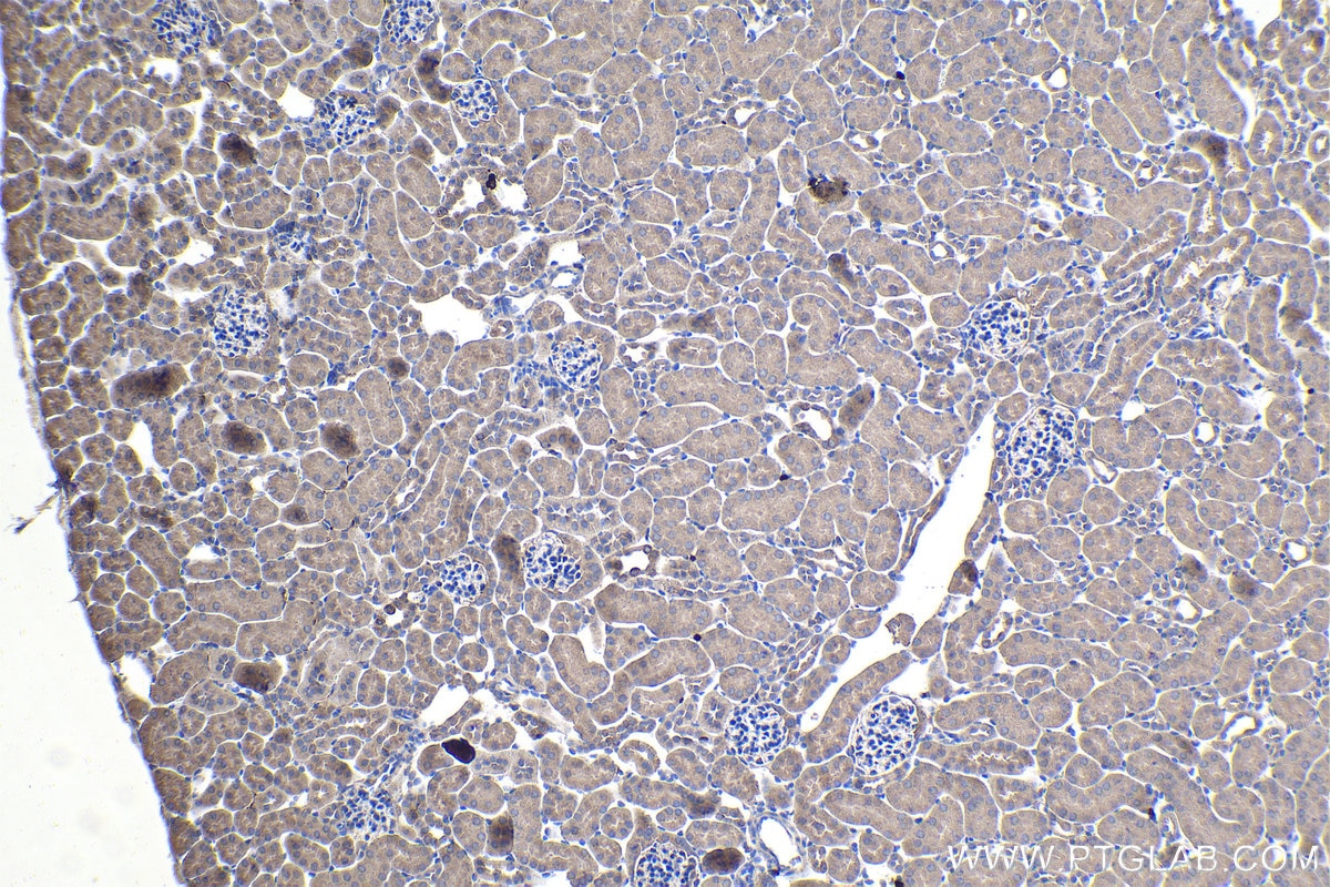 Immunohistochemical analysis of paraffin-embedded mouse kidney tissue slide using KHC1115 (ATF6 IHC Kit).