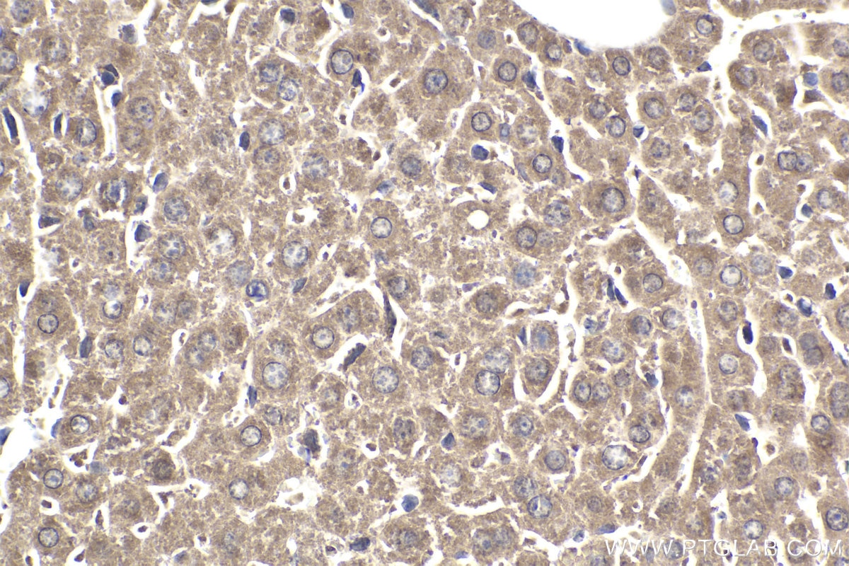 Immunohistochemical analysis of paraffin-embedded mouse liver tissue slide using KHC1899 (ATF6B IHC Kit).
