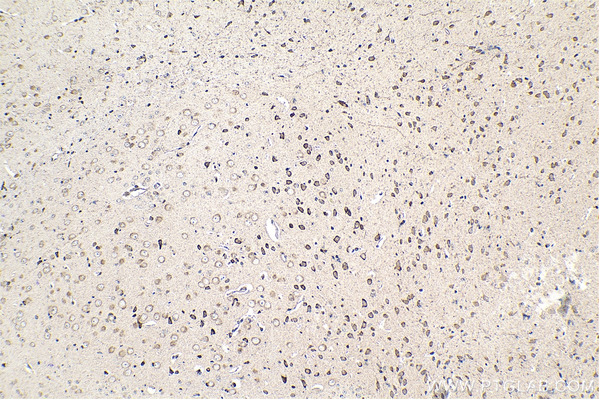 Immunohistochemical analysis of paraffin-embedded mouse brain tissue slide using KHC1553 (ATF7 IHC Kit).