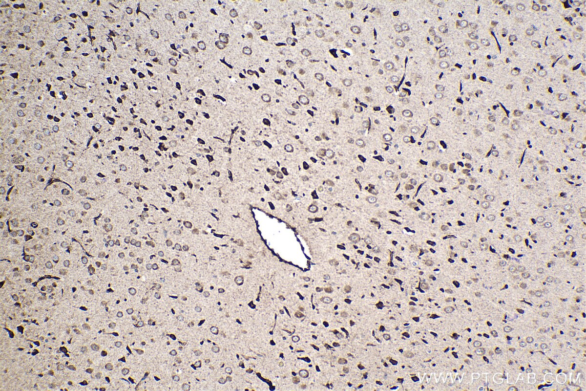 Immunohistochemical analysis of paraffin-embedded rat brain tissue slide using KHC1553 (ATF7 IHC Kit).