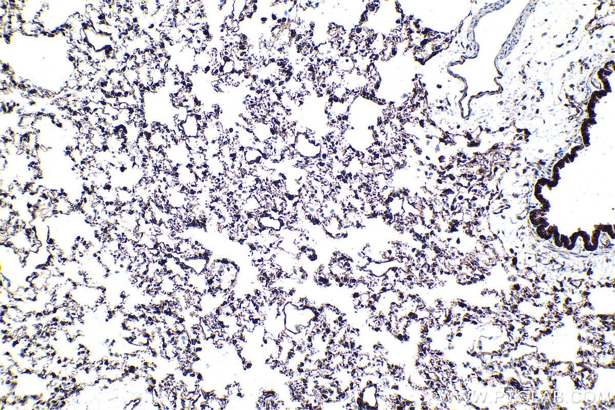 Immunohistochemical analysis of paraffin-embedded rat lung tissue slide using KHC1553 (ATF7 IHC Kit).