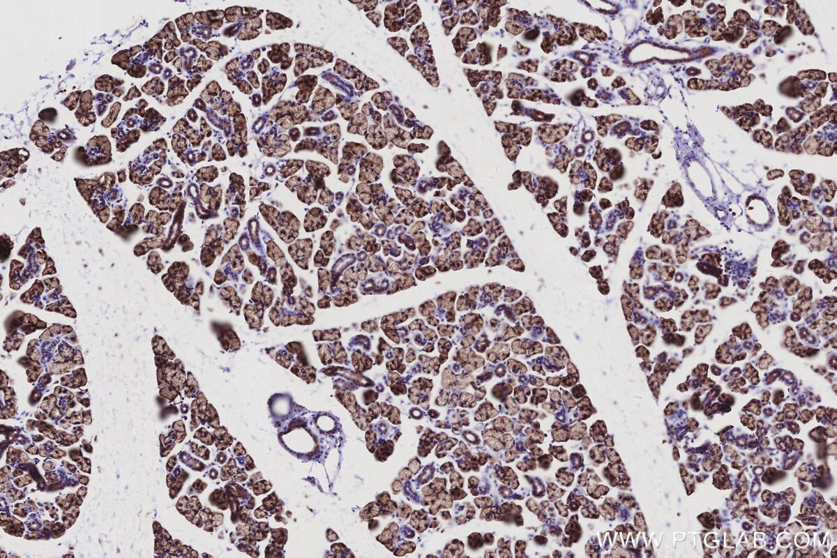 Immunohistochemical analysis of paraffin-embedded mouse salivary gland tissue slide using KHC2962 (ATP13A1 IHC Kit). Immunohistochemical analysis of paraffin-embedded mouse salivary gland tissue slide using KHC2962 (ATP13A1 IHC Kit).