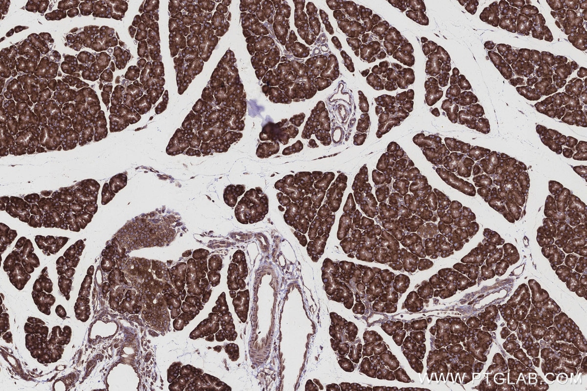 Immunohistochemical analysis of paraffin-embedded rat pancreas tissue slide using KHC2962 (ATP13A1 IHC Kit). Immunohistochemical analysis of paraffin-embedded rat pancreas tissue slide using KHC2962 (ATP13A1 IHC Kit).