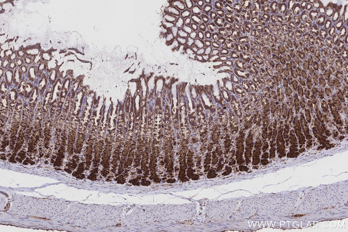 Immunohistochemical analysis of paraffin-embedded rat stomach tissue slide using KHC2962 (ATP13A1 IHC Kit). Immunohistochemical analysis of paraffin-embedded rat stomach tissue slide using KHC2962 (ATP13A1 IHC Kit).