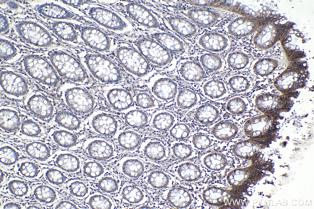 Immunohistochemical analysis of paraffin-embedded human colon tissue slide using KHC1116 (ATP1B3 IHC Kit).