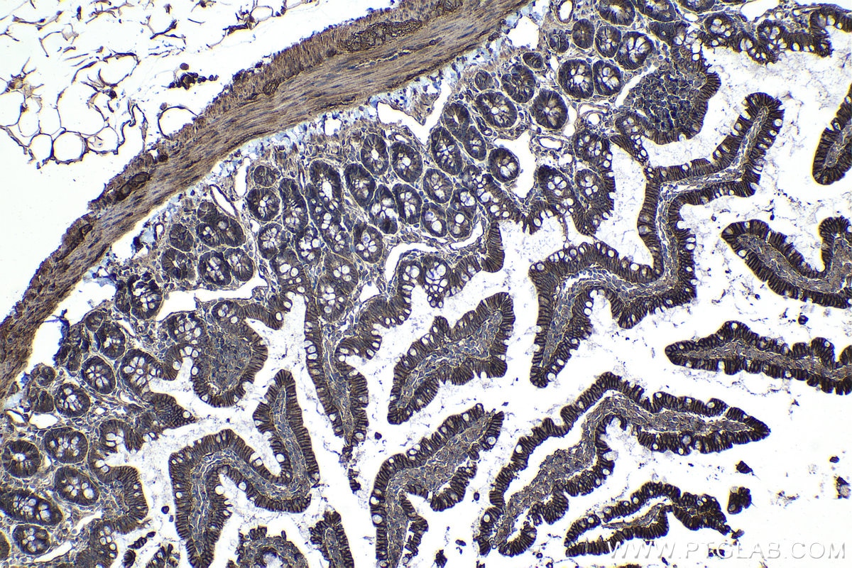 Immunohistochemical analysis of paraffin-embedded rat small intestine tissue slide using KHC1117 (ATP2B1 IHC Kit).
