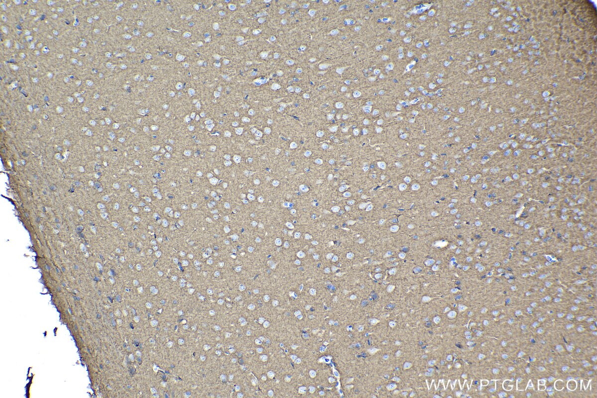 Immunohistochemical analysis of paraffin-embedded rat brain tissue slide using KHC1117 (ATP2B1 IHC Kit).