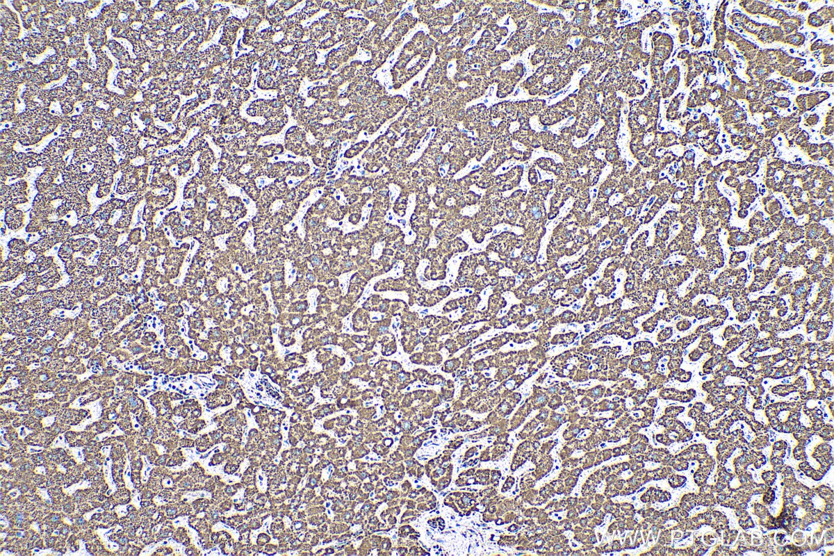 Immunohistochemical analysis of paraffin-embedded human liver tissue slide using KHC0530 (ATP5A1 IHC Kit).