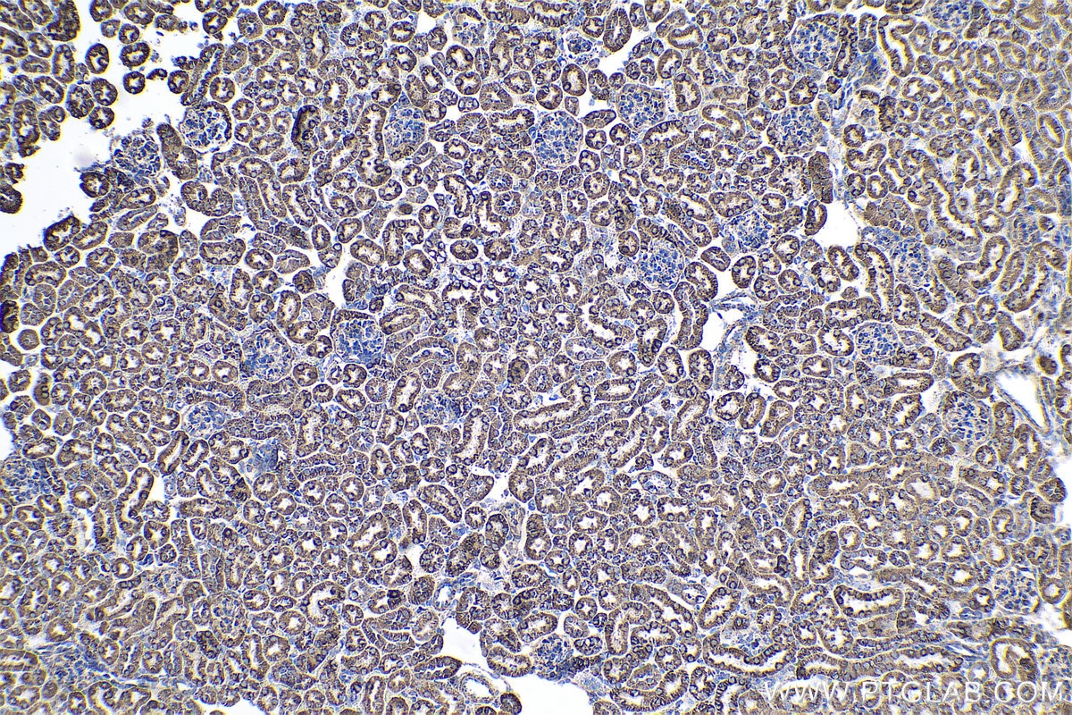 Immunohistochemical analysis of paraffin-embedded mouse kidney tissue slide using KHC0530 (ATP5A1 IHC Kit).