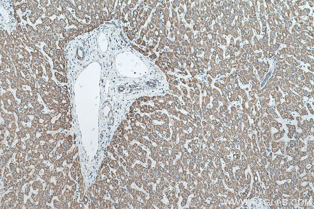 Immunohistochemical analysis of paraffin-embedded human liver tissue slide using KHC0510 (ATP5B IHC Kit).