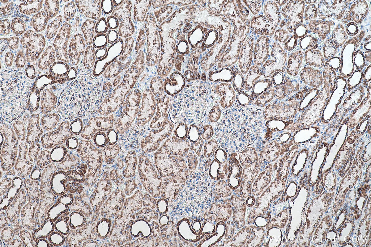Immunohistochemical analysis of paraffin-embedded human kidney tissue slide using KHC0510 (ATP5B IHC Kit).