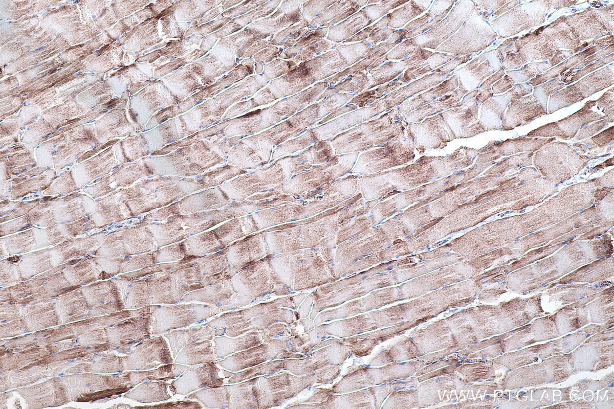 Immunohistochemical analysis of paraffin-embedded rat skeletal muscle tissue slide using KHC0510 (ATP5B IHC Kit).