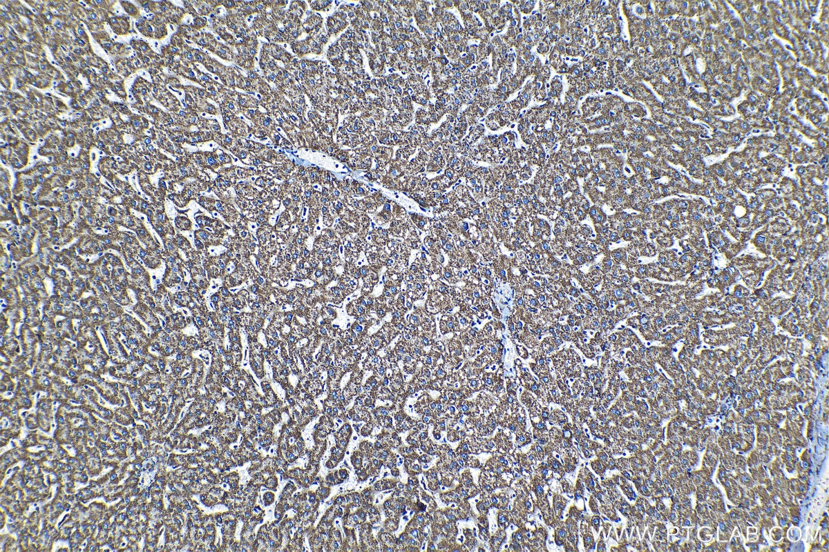 Immunohistochemical analysis of paraffin-embedded human liver tissue slide using KHC1353 (ATP5J IHC Kit).