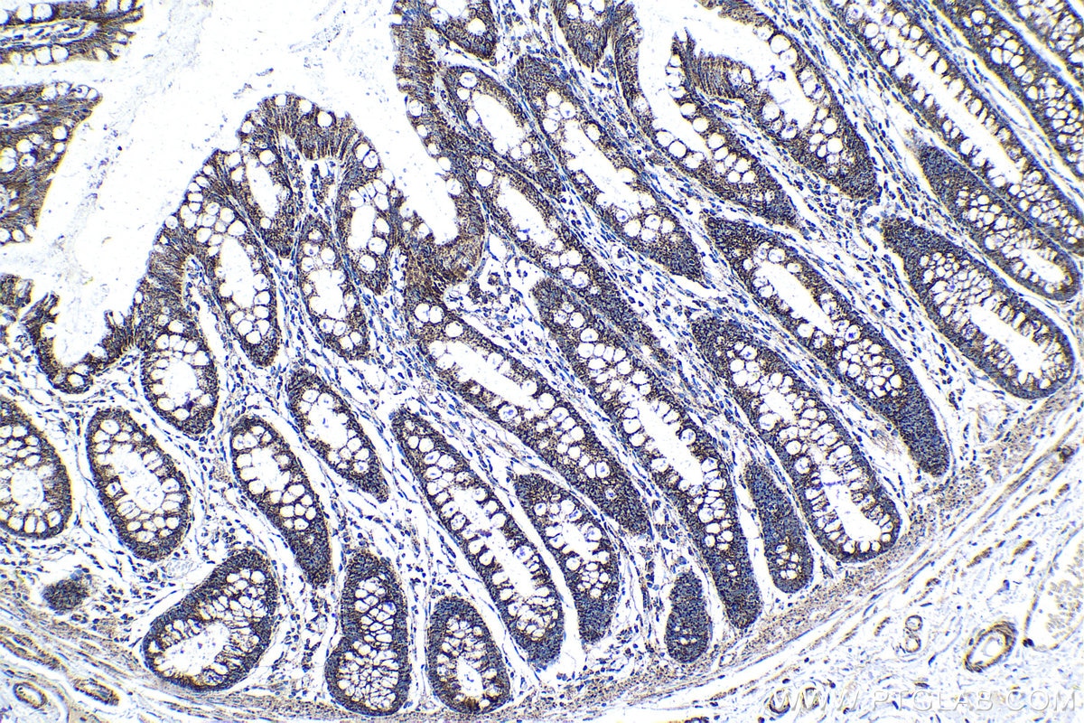 Immunohistochemical analysis of paraffin-embedded human colon tissue slide using KHC1353 (ATP5J IHC Kit).