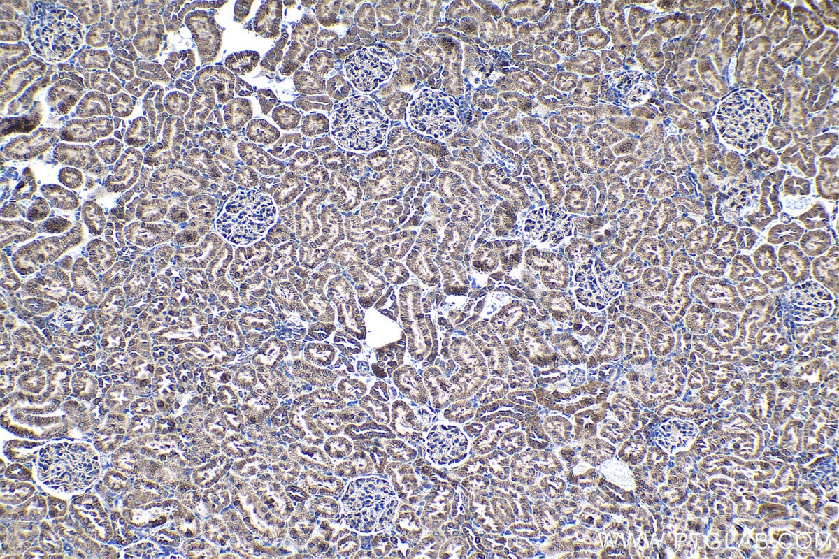 Immunohistochemical analysis of paraffin-embedded rat kidney tissue slide using KHC1353 (ATP5J IHC Kit).