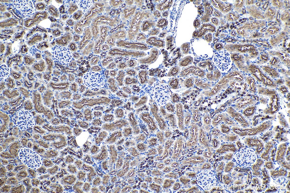 Immunohistochemical analysis of paraffin-embedded rat kidney tissue slide using KHC1354 (ATP6V1E1 IHC Kit).