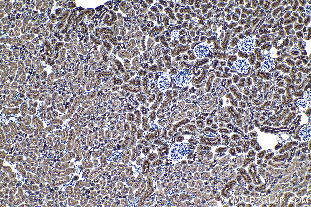 Immunohistochemical analysis of paraffin-embedded mouse kidney tissue slide using KHC1354 (ATP6V1E1 IHC Kit).