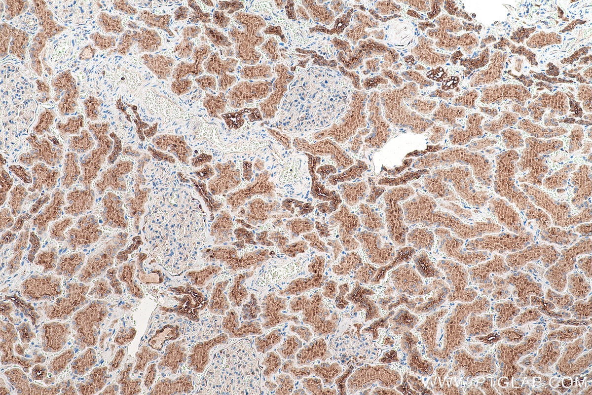 Immunohistochemical analysis of paraffin-embedded human kidney tissue slide using KHC0959 (ATP6V1G1 IHC Kit).