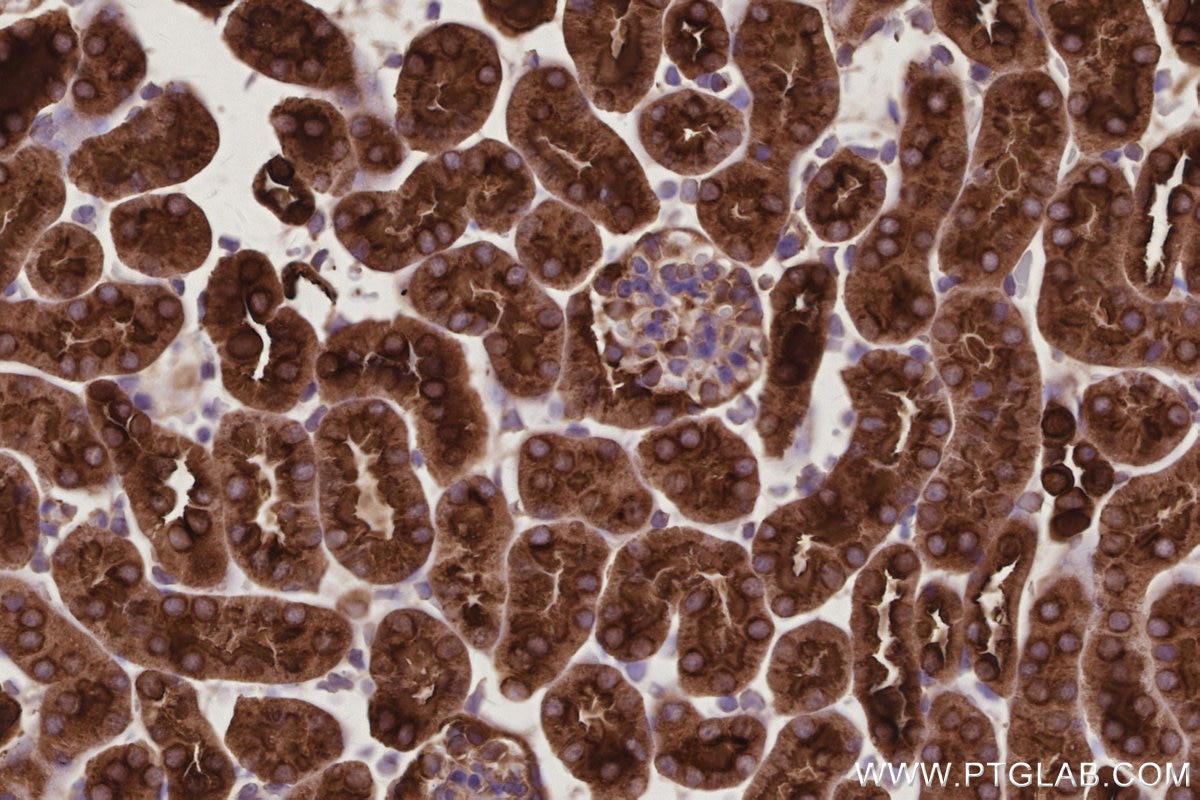 Immunohistochemical analysis of paraffin-embedded mouse kidney tissue slide using KHC3027 (ATP6V1H IHC Kit). Immunohistochemical analysis of paraffin-embedded mouse kidney tissue slide using KHC3027 (ATP6V1H IHC Kit).
