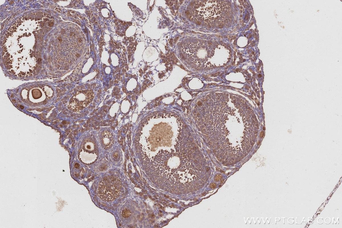 Immunohistochemical analysis of paraffin-embedded mouse ovary tissue slide using KHC3027 (ATP6V1H IHC Kit). Immunohistochemical analysis of paraffin-embedded mouse ovary tissue slide using KHC3027 (ATP6V1H IHC Kit).