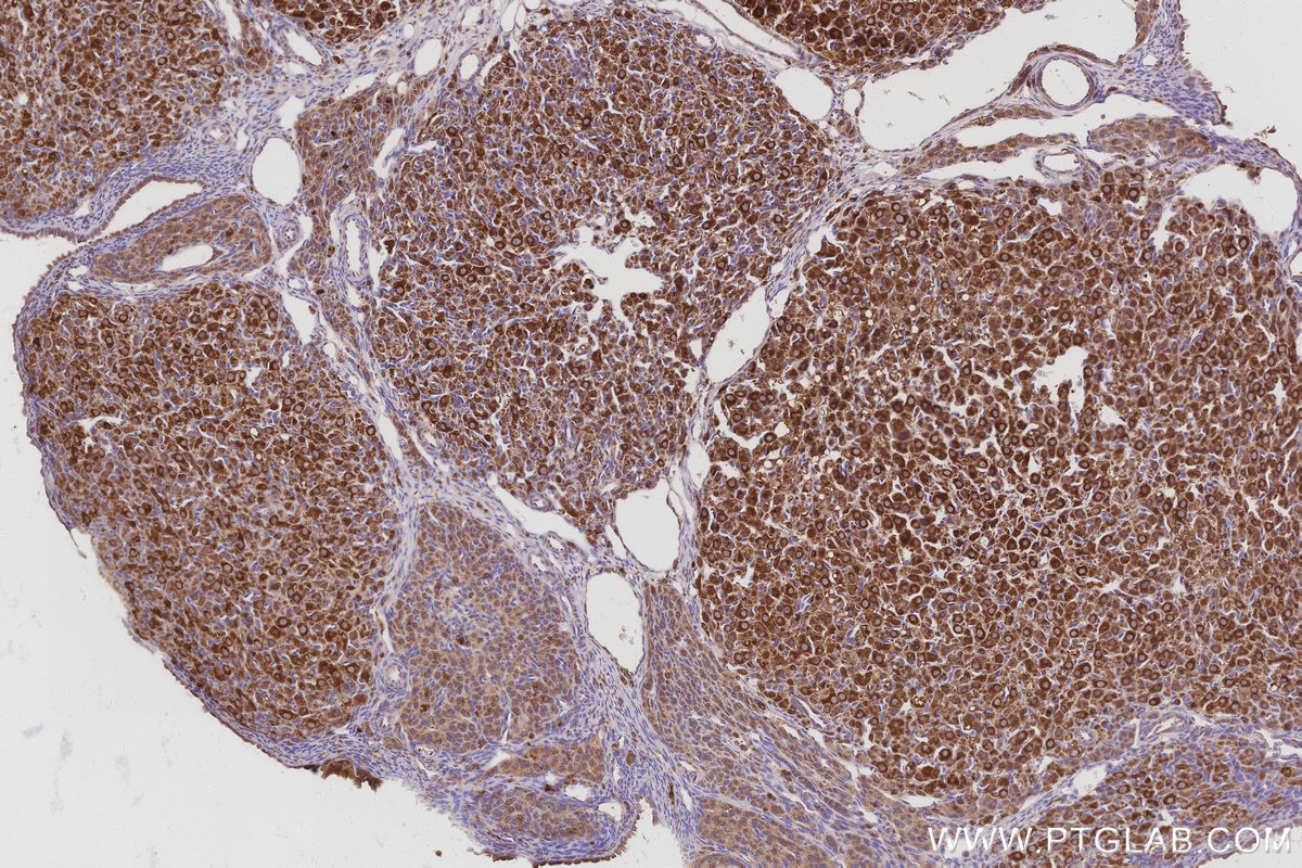 Immunohistochemical analysis of paraffin-embedded rat ovary tissue slide using KHC3027 (ATP6V1H IHC Kit). Immunohistochemical analysis of paraffin-embedded rat ovary tissue slide using KHC3027 (ATP6V1H IHC Kit).