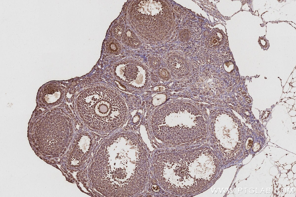 Immunohistochemical analysis of paraffin-embedded mouse ovary tissue slide using KHC3056 (ATP8A1 IHC Kit).